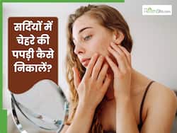 सर्दियों में चेहरे की ड्राई स्किन और पपड़ी कैसे निकालें? ये 5 चीजें हैं बेहद कारगर, जरूर करें ट्राई