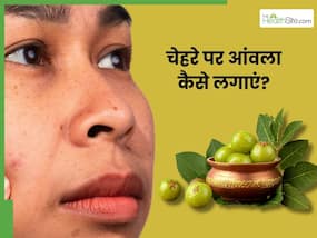 सर्दियों में चेहरे पर आंवला कैसे लगाएं? जानें, फेसपैक बनाने की विधि, जिससे स्किन होगी साफ
