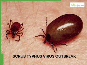 Andhra Pradesh Sees Sharp Rise in Scrub Typhus Virus: Understanding the Warning Signs and Its Expanding Threat in India Andhra Pradesh Sees Sharp Rise in Scrub Typhus Virus: Understanding the Warning Signs and Its Expanding Threat in India