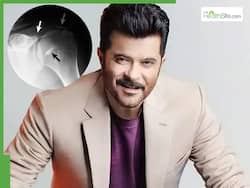 Anil Kapoor Diagnosed With Right Shoulder Calcification: What Does The Condition Mean?