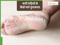 सर्दियों में फटी एड़ियों से हैं परेशान तो अपनाएं ये टिप्स, 2-3 दिनों में दिखेगा असर