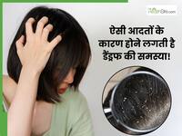 इन आदतों की वजह से बालों में होने लगते हैं डैंड्रफ, आज की छोड़ें ऐसे Bad Habits