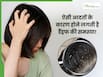 इन आदतों की वजह से बालों में होने लगते हैं डैंड्रफ, आज की छोड़ें ऐसे Bad Habits