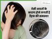 इन आदतों की वजह से बालों में होने लगते हैं डैंड्रफ, आज की छोड़ें ऐसे Bad Habits