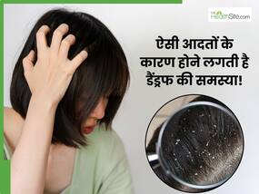 इन आदतों की वजह से बालों में होने लगते हैं डैंड्रफ, आज की छोड़ें ऐसे Bad Habits