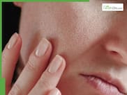 From Castor Oil To Coconut Oil: 5 Natural Ways To Treat Dry, Flaky Winter Skin