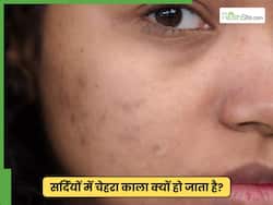 सर्दी में चेहरे की रौनक खो रही है तो आजमाएं ये 3 उपाय, खिल उठेगा निखार