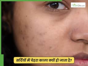 सर्दी में चेहरे की रौनक खो रही है तो आजमाएं ये 3 उपाय, खिल उठेगा निखार सर्दी में चेहरे की रौनक खो रही है तो आजमाएं ये 3 उपाय, खिल उठेगा निखार