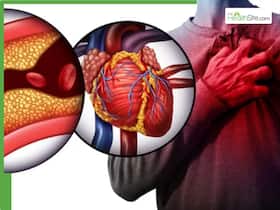 5 Hidden Lifestyle Triggers That Are Quietly Raising Your Heart Disease Risk