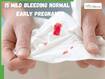 Is Mild Bleeding Normal In Early Pregnancy? What Doctors Say About Common Causes