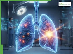 New Blood Test Can Detect Lung Cancer In Real Time For Earlier Diagnosis And Faster Treatment