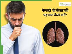 फेफड़ों  के कैंसर की पहचान कैसे करें? इन 3 संकेतों को गलती से भी न करें इग्नोर