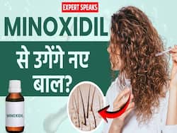 क्या Minoxidil सीरम बालों का झड़ने से रोकेगा और उगाएगा नए बाल? जानें क्या कहते हैं एक्सपर्ट