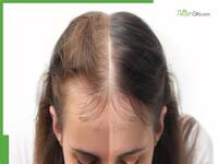 Hot Oil Massage Vs Cold Oil Massage: Which One Works Better For New Hair Growth?