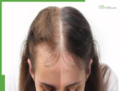 Hot Oil Massage Vs Cold Oil Massage: Which One Works Better For New Hair Growth