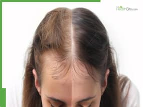 Hot Oil Massage Vs Cold Oil Massage: Which One Works Better For New Hair Growth