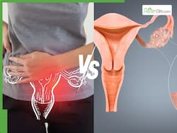 PCOD Vs PCOS: What   s The Real Difference     And Can Both Affect Pregnancy? Experts Explain