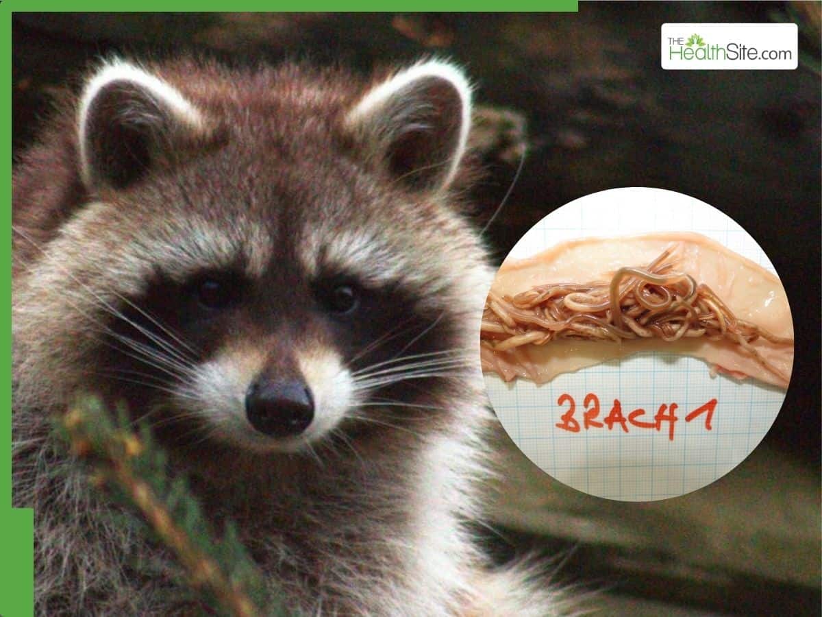 What Is Raccoon Roundworm? Parasite Posing Severe Neurological Threat To Humans Now Found In Nine European Countries