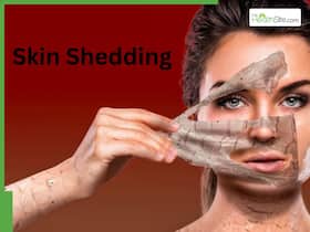 The Secret Behind Skin Shedding: Why It Happens And How To Manage It The Secret Behind Skin Shedding: Why It Happens And How To Manage It