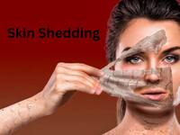 The Secret Behind Skin Shedding: Why It Happens And How To Manage It