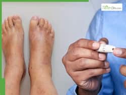 Type-2 Diabetes Symptoms In Feet: 7 Warning Signs You Should Never Ignore
