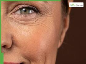 How To Reduce Wrinkles On Face: 5 Tips To Deal With Skin Ageing How To Reduce Wrinkles On Face: 5 Tips To Deal With Skin Ageing