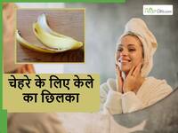 Banana Skin Face Pack: सर्दियों की धूप सा चमकने लगेगा चेहरा, केले के छिलके से ऐसे बनाएं फेस पैक