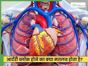 आर्टरी ब्लॉक होने का क्या मतलब होता है? डॉक्टर ने बताया कैसे कर सकते हैं ठीक