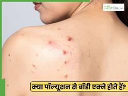 क्या कपड़ों और स्किन पर पॉल्यूशन पार्टिकल रह जाने से शरीर पर एक्ने हो सकते हैं? डॉक्टर से जानें