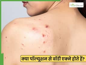 क्या कपड़ों और स्किन पर पॉल्यूशन पार्टिकल रह जाने से शरीर पर एक्ने हो सकते हैं? डॉक्टर से जानें