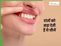 इन चीजों की वजह से सड़ने लगते हैं दांत, खाने की न करें गलती