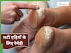DIY Crack Foot Cream: रोज रात को सोने से पहले फटे पैरों पर लगाना शुरु करें ये क्रीम, मक्खन सी जाएंगी एड़ियां