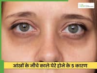 पूरी नींद लेने के बाद डार्क सर्कल्स क्यों होते हैं?