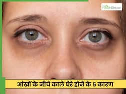 पूरी नींद लेने के बाद डार्क सर्कल्स क्यों होते हैं?