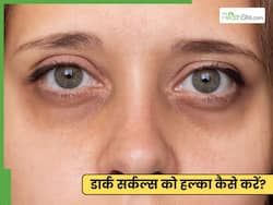 आंखों के नीचे से काले घेरे हटाने के लिए क्या करें? 5 तरीकों से दूर होंगे डार्क सर्कल्स