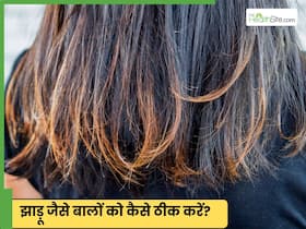 सर्दियों में बाल झाड़ू जैसे जड़ जड़ क्यों हो जाते हैं?
