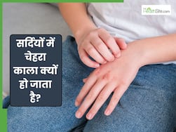 हाथ बार-बार ड्राई हो जाते हैं? जानें 5 तरीके जो दूर करेंगे ड्राई स्किन की समस्या