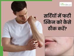 सर्दियों के फटी-फटी सी रहती है स्किन, ये 5 घरेलू उपाय हैं बेहद असरदार, जरूर करें ट्राई