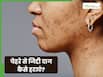 चेहरे से जिद्दी दाग कैसे हटाएं? जानें 5 तरीके जो दूर करेंगे हर स्किन प्रॉब्लम