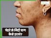 चेहरे से जिद्दी दाग कैसे हटाएं? जानें 5 तरीके जो दूर करेंगे हर स्किन प्रॉब्लम