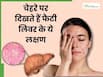 चेहरे पर दिखने वाले ये 4 लक्षण हो सकते हैं फैटी लिवर के लक्षण, ड्रिंक करने वाले जरूर दें ध्यान