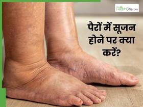 सर्दियों में पैर क्यों सूज जाते हैं? जानें कारण और सूजन कम करने के 3 उपाय