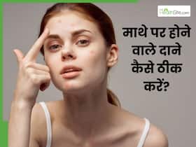माथे पर आने वाले दानों को कैसे ठीक करें? जानें 5 तरीके जो ठीक करेंगे समस्या
