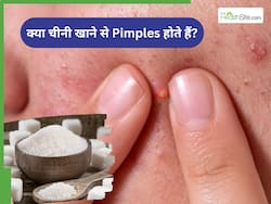 क्या चीनी खाने से सच में होते हैं पिंपल्स? डर्मेटोलॉजिस्ट ने जो बोला वो सुनने वाला हैैैैैैैैैैैै