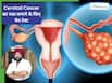 भारत में महिलाओं का सबसे बड़ा खतरा Cervical Cancer, इस टेस्ट को करवाने से बच सकती है जान