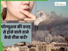 पॉल्यूशन की वजह से चेहरे पर हो गए हैं दाने, तो लगाएं ये 5 चीजें, दूर होगी समस्या