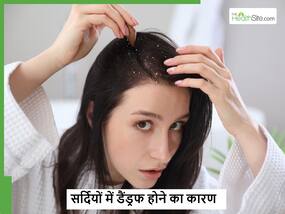 Dandruff in Winter: सर्दियों में इन 3 कारणों से बालों में होने लगती है रूसी, जानें कैसे पाएं इससे छुटकारा