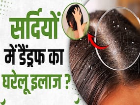 सर्दियों में डैंड्रफ हटाने के लिए अपनाएं ये घरेलू नुस्खे