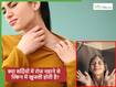 रोज नहाने से खुजली क्यों होने लगती है? कहीं ये कोई स्किन डिजीज तो नहीं