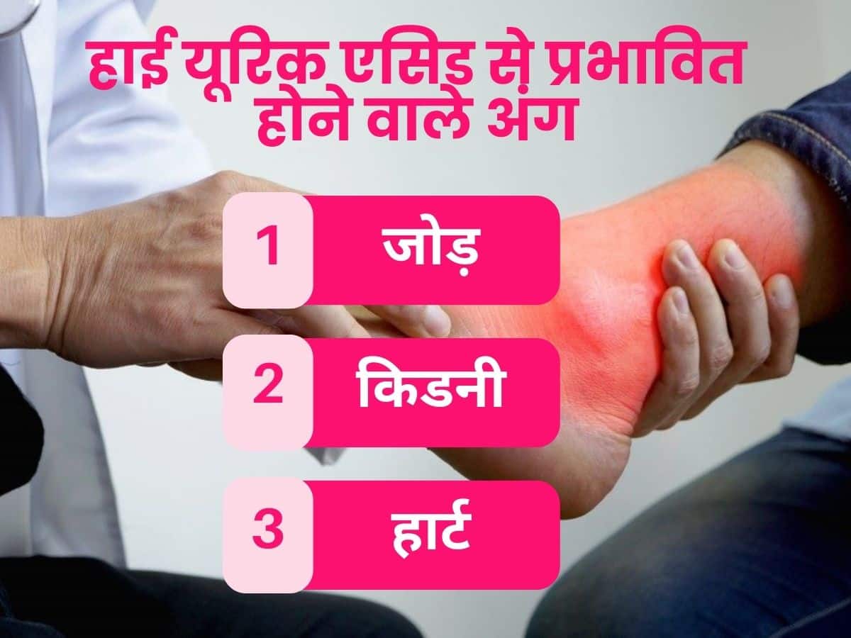 high uric acid